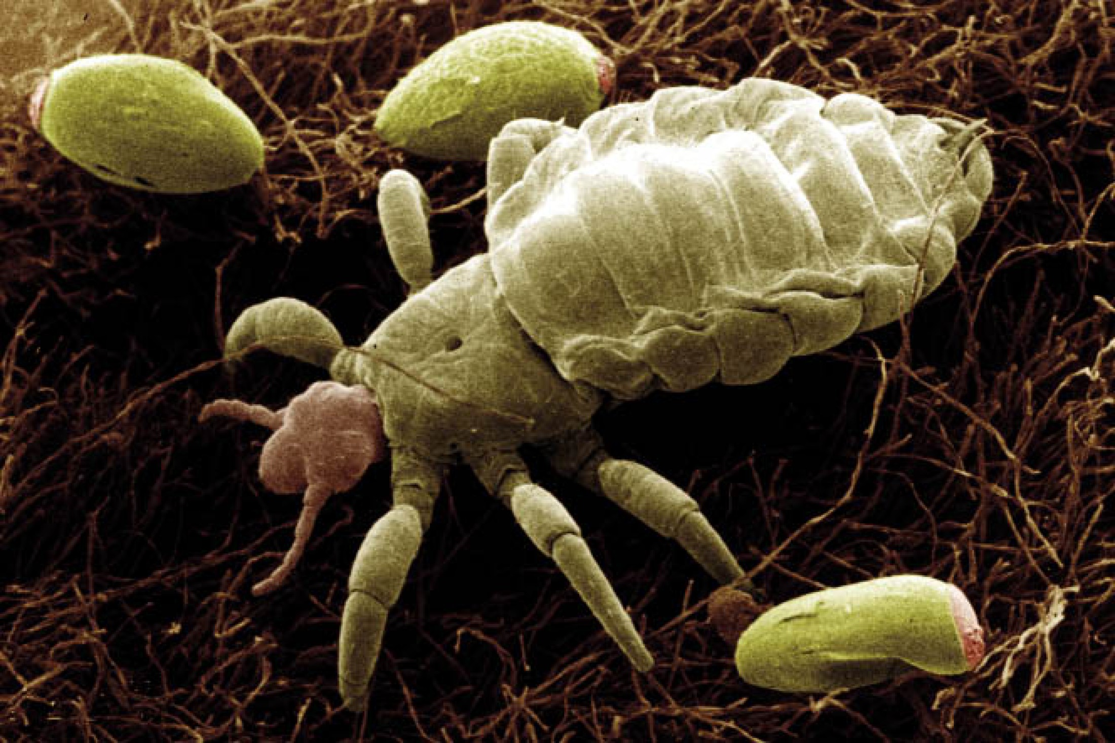 : Elektronenmikroskopische Aufnahme einer Kleiderlaus mit Nissen (Länge ca. 4 mm). (Bild: H. Mehlhorn)