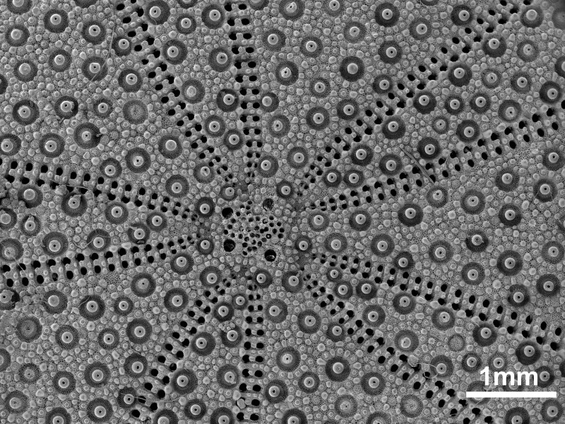 SE-Bild eines Seeigels : SE-Bild eines Seeigels